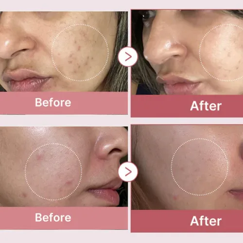 Medicube / מדיקיוב -  סרום פפטיד ורוד PDRN 30 מ"ל  